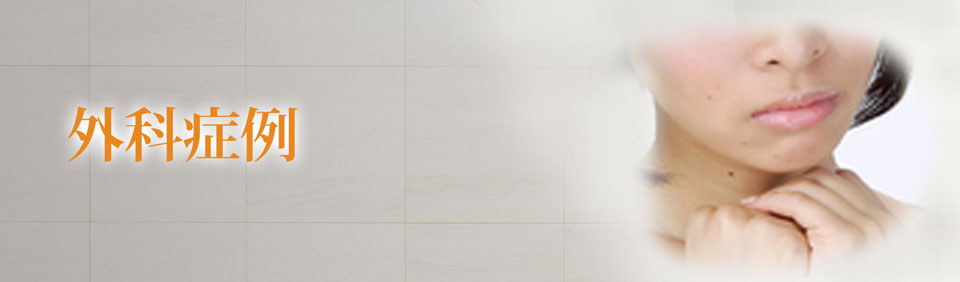 外科症例